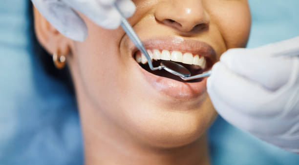 Best Emergency Wisdom Tooth Extraction in Dauphin, PA